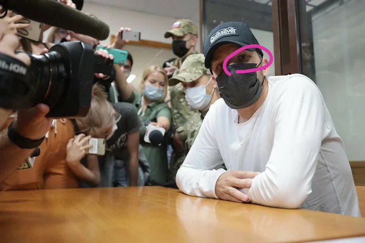 Сооснователю финансовой пирамиды Finiko Кириллу Доронину ещё до суда кто-то поставил синяк под глазом